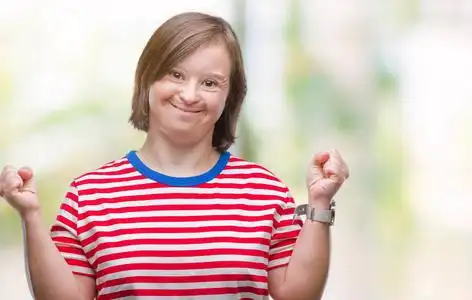 唐氏综合征的概念图片