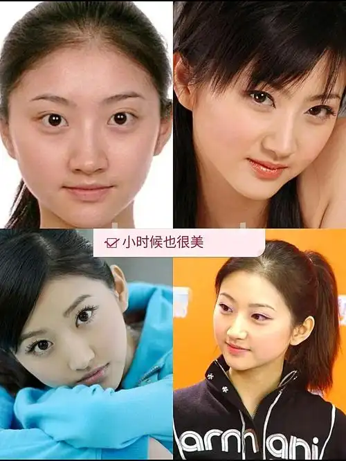 邀先来盘点一下景甜双眼皮的变化 ▲景甜和李小璐一样,都是原生双眼皮