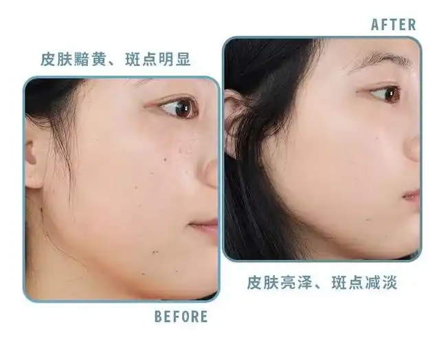 5%阿魏酸,它们可以协同合作,一起帮助皮肤中和体内的自由基,提升抗