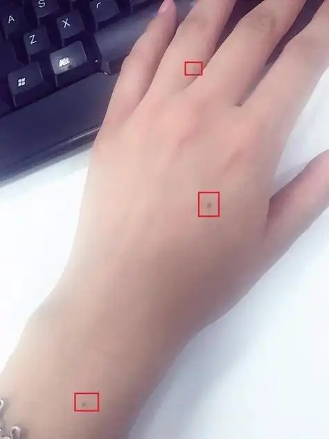 女人右手虎口有痣寓意(女人右手虎口有痣寓意是什么)