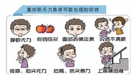 重症肌无力病友微创手术前后真实感受