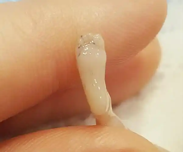 孕龄到了这个月别轻易打掉ta,14周胎儿的实拍图,愿你能善良