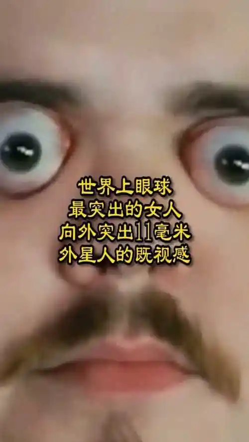 世界上眼球最突出的人向外突出11毫米外星人的既视感