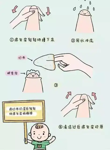 男孩包皮多长算正常男孩包茎多大