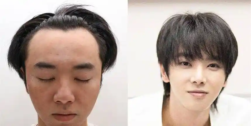 团队包装可谓"整容",4位顶流男明星对比,蔡徐坤犹如"换脸"_华晨宇_王