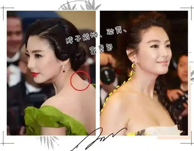 有严重的脖子前倾,圆肩驼背问题,显得上半身很壮!