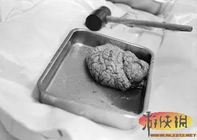 实拍法医解剖室解剖尸体的真实场面 恐怖震撼