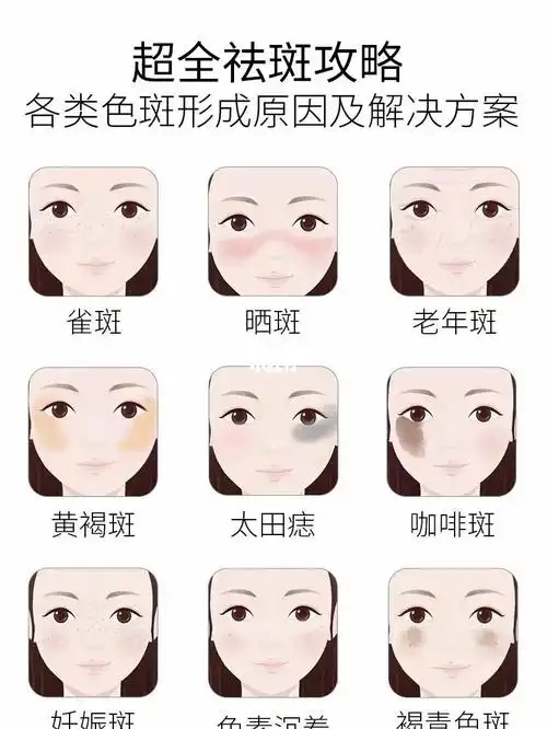 常见斑种科普以及应对方法