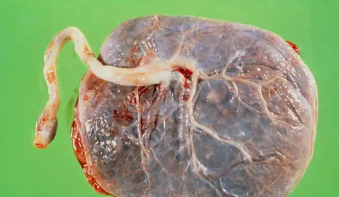 胎盘真的有营养吗能吃吗说出来你可能都不信