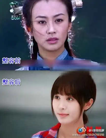 李易峰难逃姓李整容女 李菲儿整容前后对比照被扒