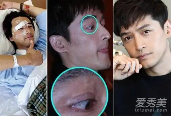 胡歌刘涛王凯张琰琰琅琊榜演员今昔对比照