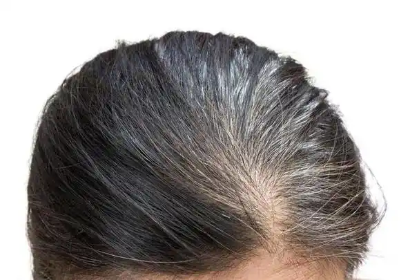 为什么年轻人会长白头发,哈佛大学研究:经常长白头发的人,患癌风险会