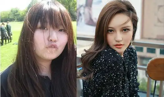 网传周扬青整容前后对比照