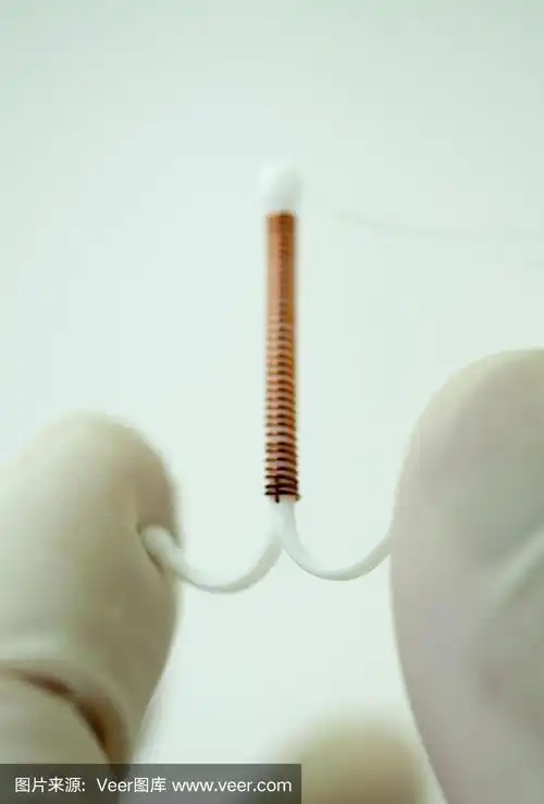 铜节育器,宫内节育器.