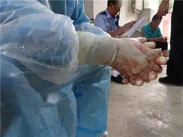 我妻子割腕自杀了云南一男子紧急报警求助结果万万没想到