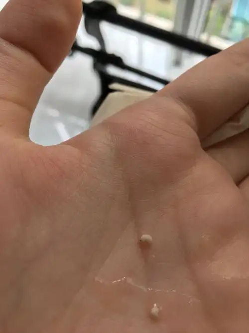 今天红豆粥里的虫子有人知道是什么虫吗