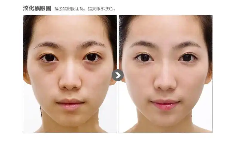 0 涂抹式眼部精华 3分钟去眼袋 黑眼圈 眼周细纹 1kg