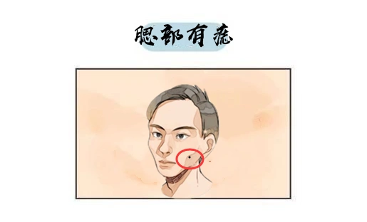 原创身体4颗破财痣留不得花钱大手苦日子难翻身必须点掉