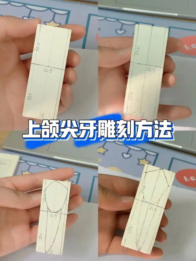 上颌尖牙的雕刻方法也很简单,首先在相对两侧绘图(可以是唇舌面或者是