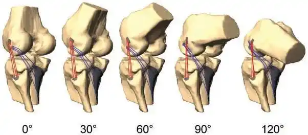 膝关节突然无法伸直/弯曲,如何解锁?