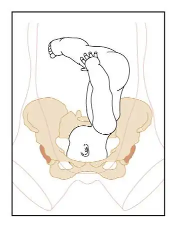 孕妈妈入盆是什么感受?要看6大主要表现,1张趣味图,1张专业图