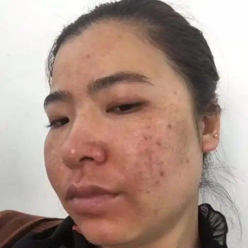 拒绝做"斑点"女人,色斑护理有3个办法,突发情况也有妙招|遮瑕|长斑|遮