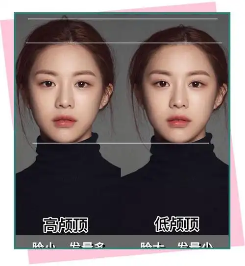 低颅顶女生有多惨看赵丽颖iu就知道了