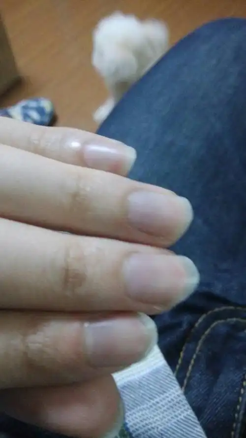为什么我的指甲发紫?是不是身体什么有问题