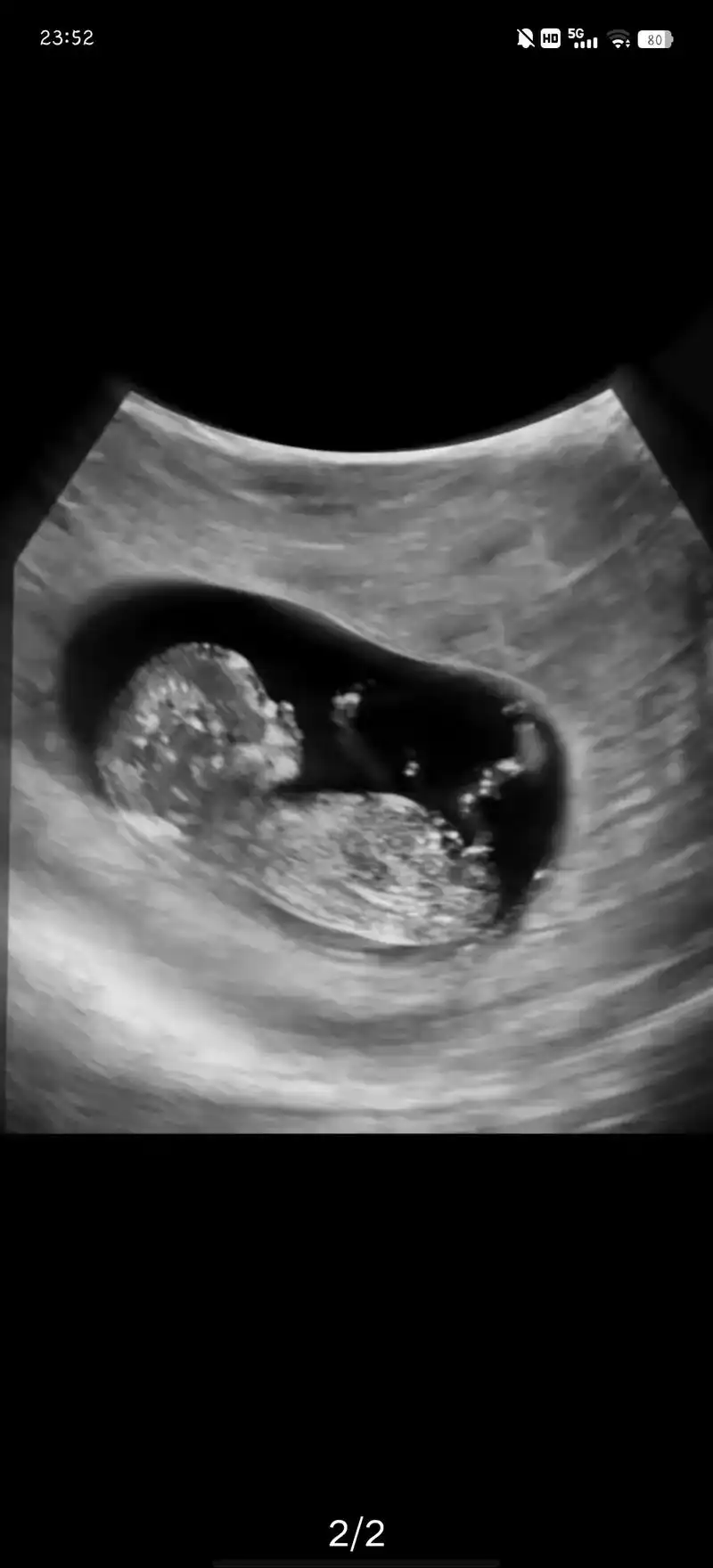 宝宝又长大了,很快就三个月了,真是一个磨人的小淘气,还在肚子 - 抖音