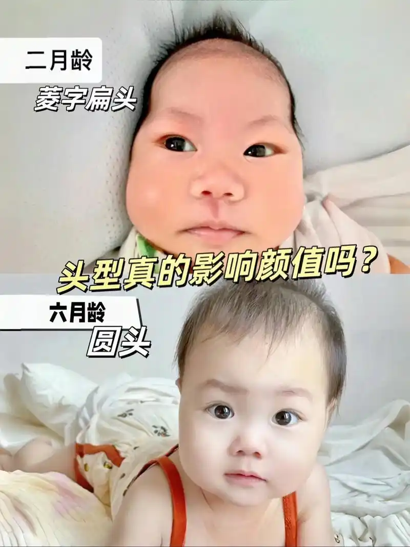 宝宝长时间歪头睡,为了避免睡成偏头斜颈