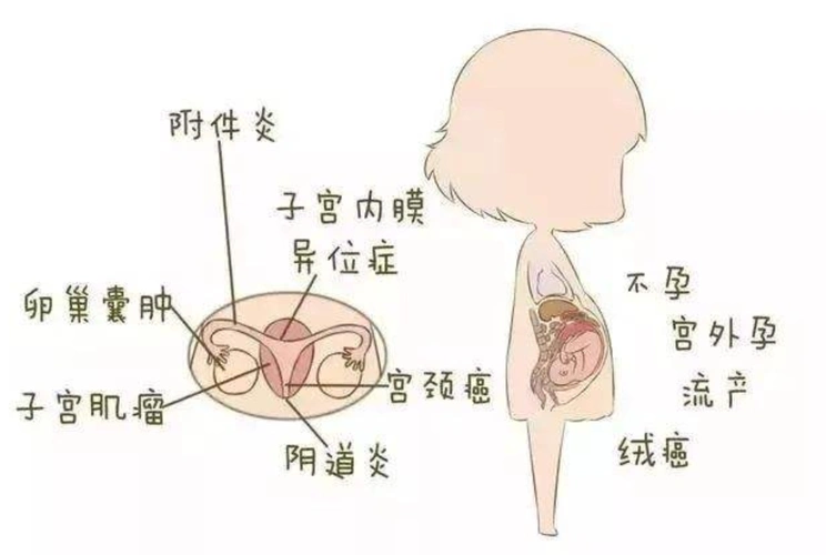 妇科疾病的常见症状有哪些?