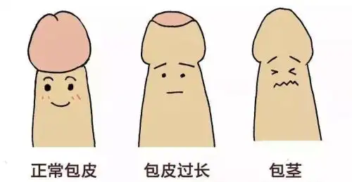 包皮手术后注意什么