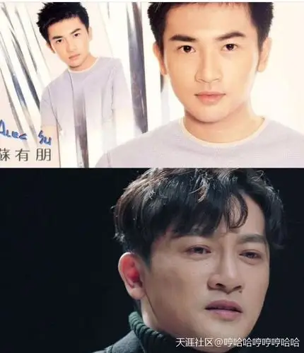 盘点整容后判若两人的换脸艺人!_苏有朋