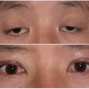 沈国雄医生的帖子分享_悦美整形