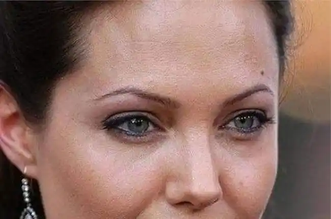 甄眙:皮肤粗糙?这样做.