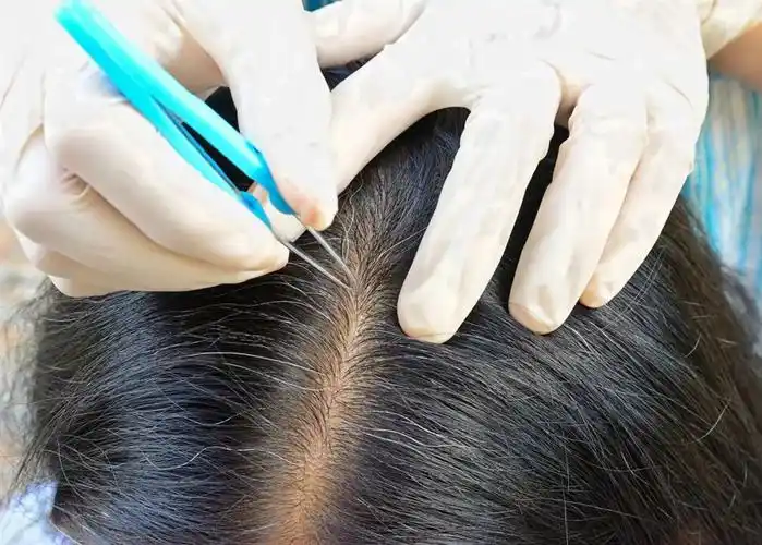 白头发拔一根长三根?到底该不该拔?终于弄清楚了!