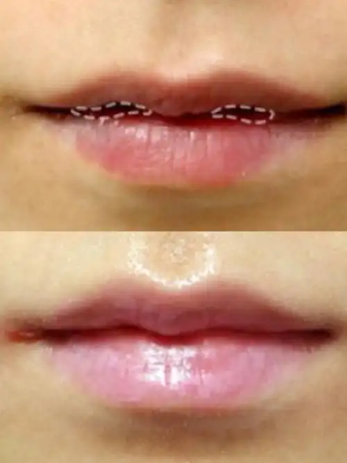 眼睛足够漂亮,即使是塌鼻梁,拥有好看的嘴巴也是超级吸睛  比如iu