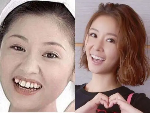 林心如这个可以很具有代表性了