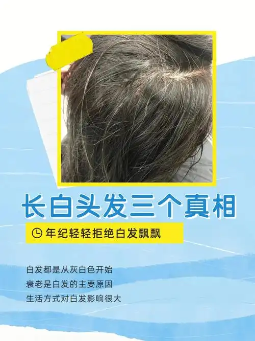 爱长白发的看过来60这里出了原因