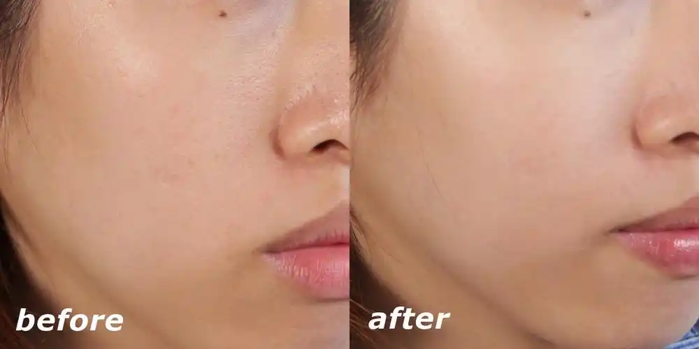 点进来看使用前后会被吓死啊!超强补水除皱霜让你肌肤水当当!