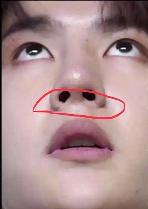 王一博氪金粉脱粉回踩鼻子疤痕明显跳舞少摸裆美合是真的