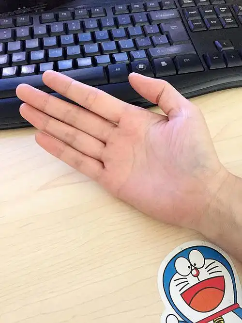 妈蛋!这次手心也有了!