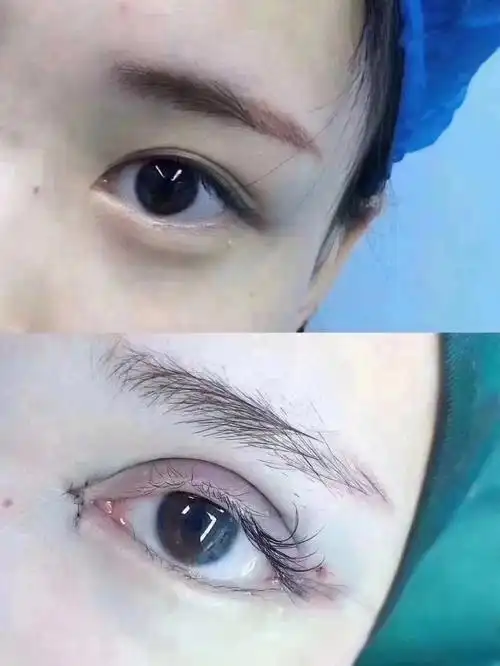 爱心我想割双眼皮等放假等过年等