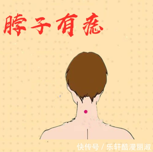 男人5大发财痣,个个财大气粗,有积蓄,有房产,得财神爷照顾!