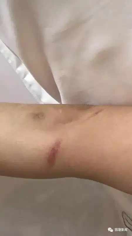 永州人要注意了以后拿快递要注意人身安全了