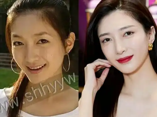 拥有一双美丽眼睛的重要性.盘点割过双眼皮的明星