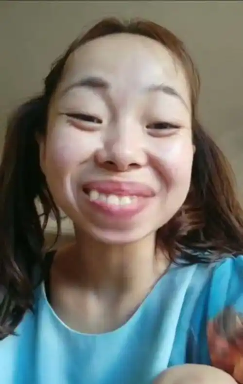 嘟嘟姐遭粉丝举报原因竟是嘟嘟嘴令人反感