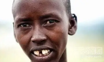 这个民族的审美太奇怪 人人都要敲掉大门牙!