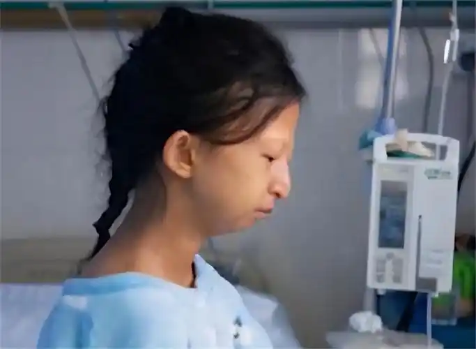 贵州女孩为救弟弟连吃5年辣椒拌饭去世前仅43斤请求捐献遗体