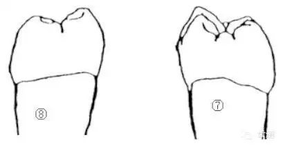 右下颌第一磨牙解剖图简笔画